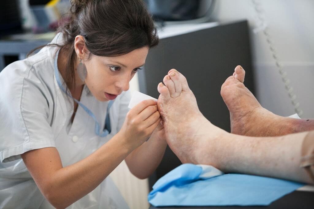 How To Manage Diabetic Foot?