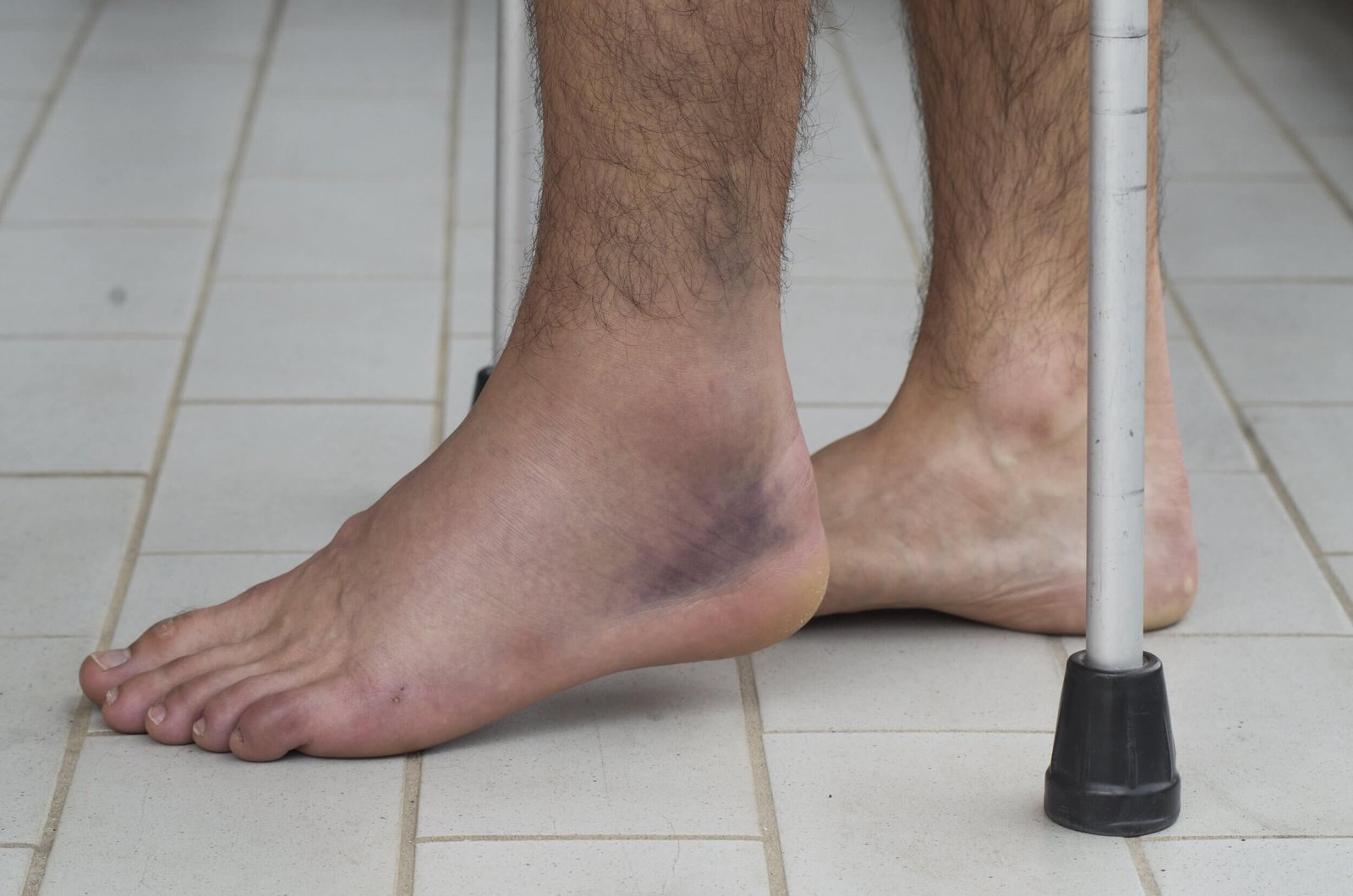 How To Strengthen Your Ankle After A Sprain