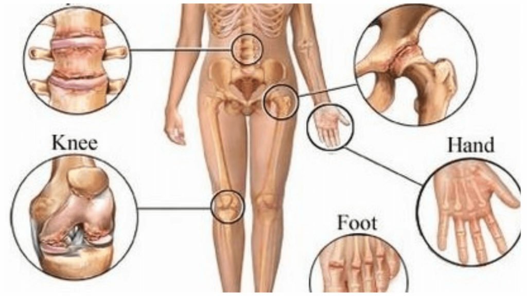 Reasons For Joint Pain 